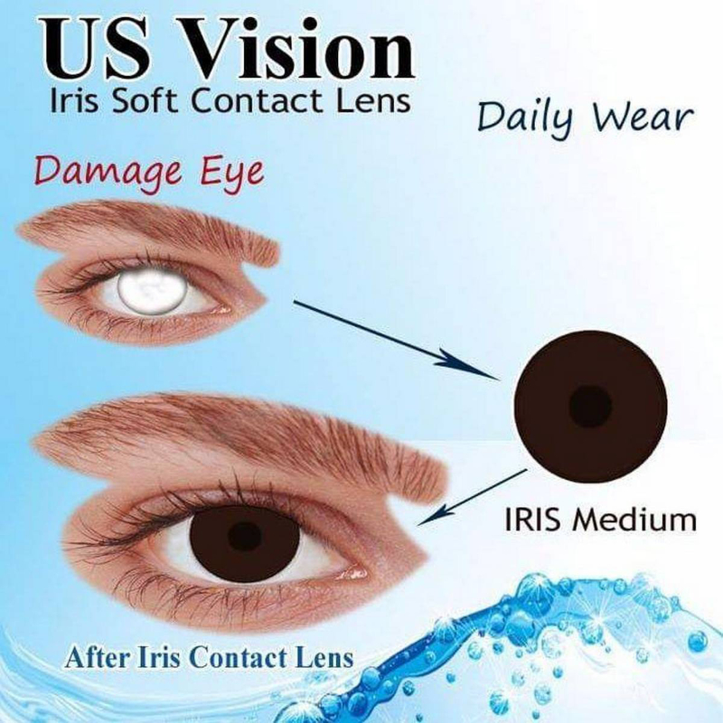 Lens for Damage Eye Extended Wear Iris Medium+Free Kit