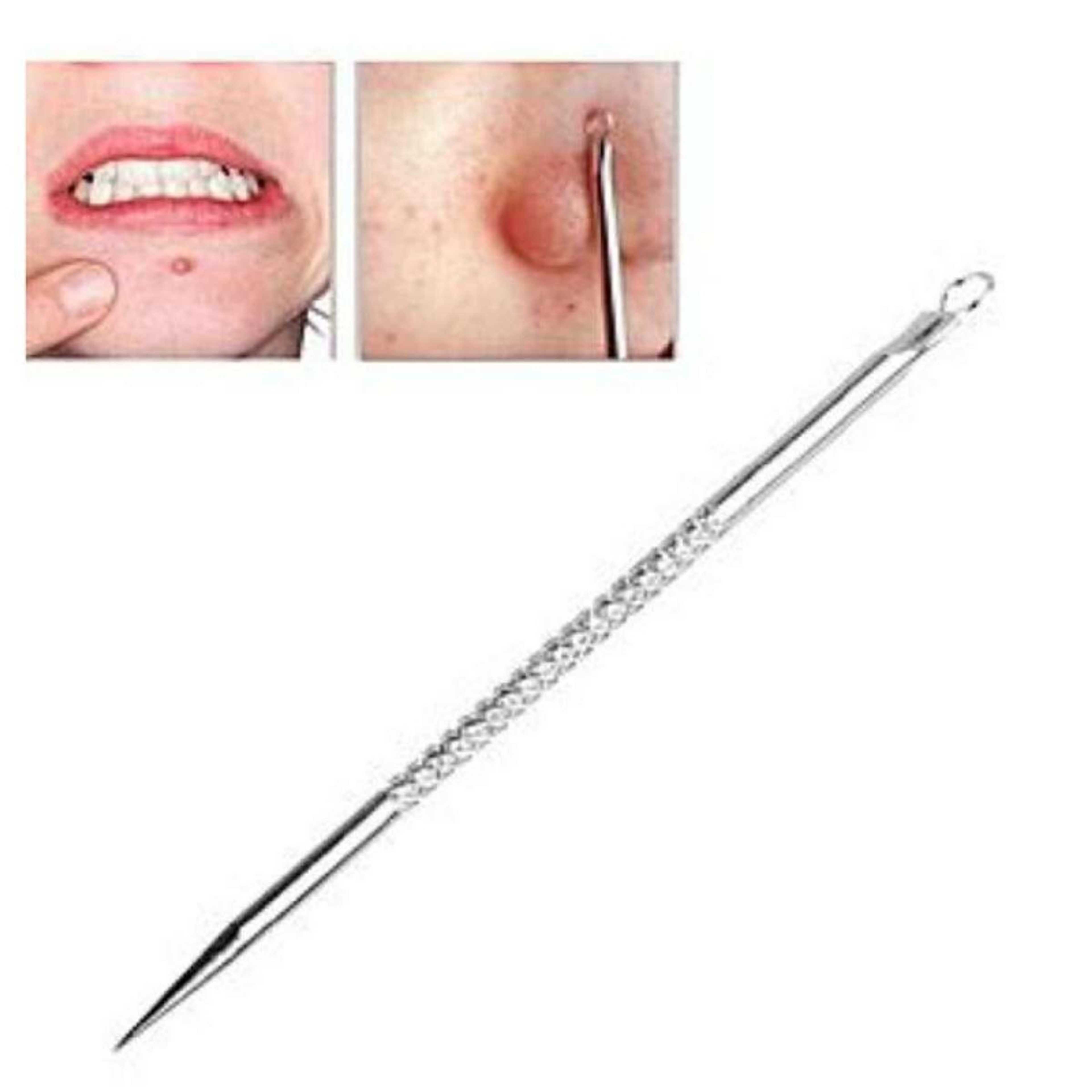 Pimple and Blackhead Remover Stick