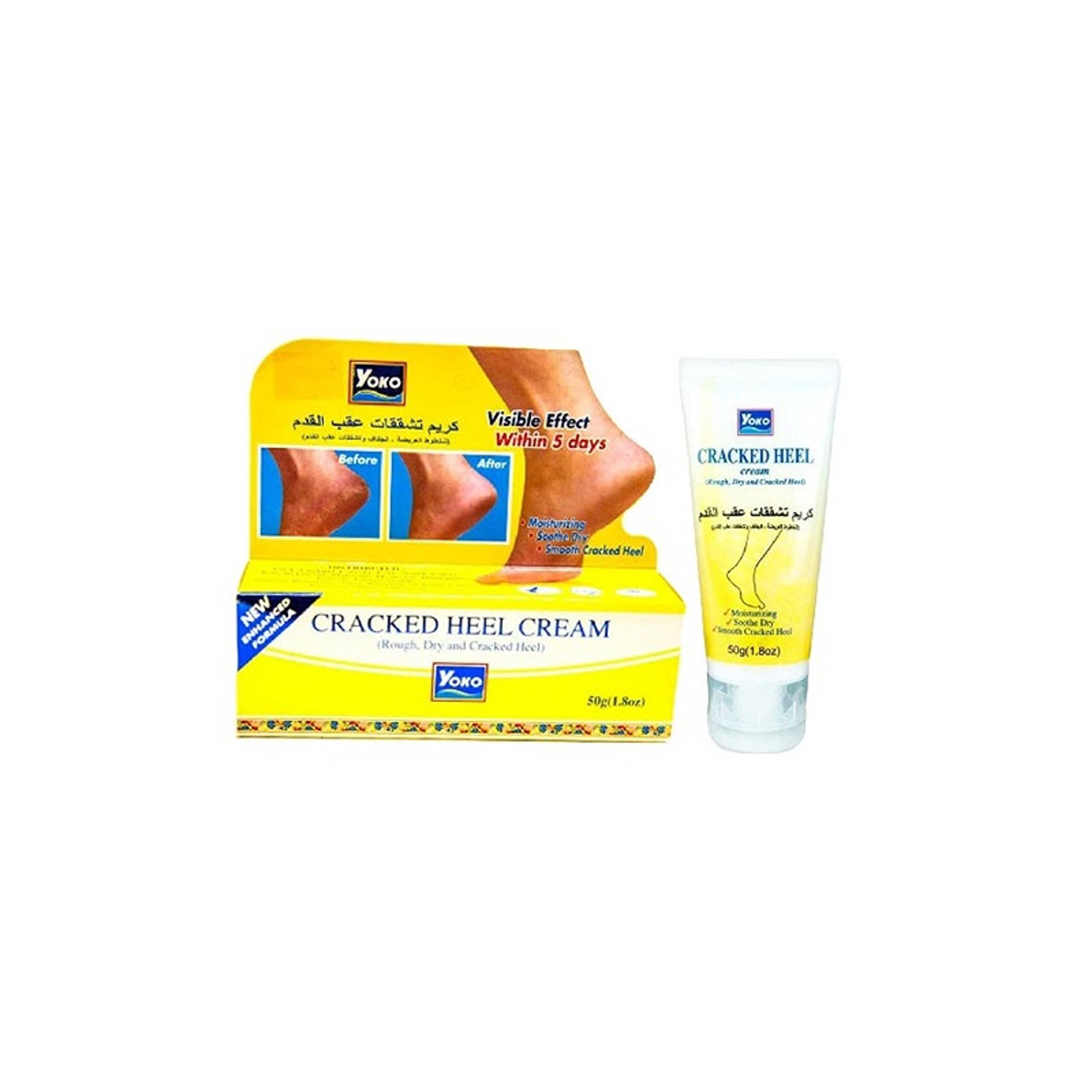 YOKO-Cracked Heel Cream 50grams - Product Main Image